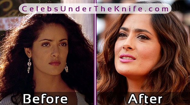 Salma Hayek Plastic Surgery Rumors