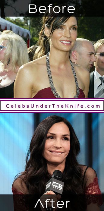 Famke Janssen S Plastic Surgery Gorgeous Yes Surgery Maybe