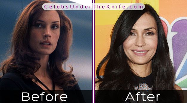 Famke Janssen Plastic Surgery Rumors