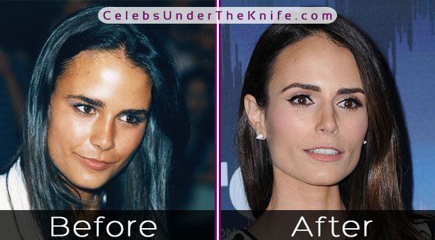 Jordan Brewster Plastic Surgery Photos