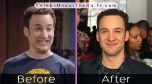 Ben Savage Before and After Pictures