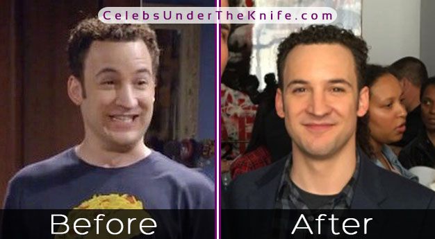 Ben Savage Before and After Pictures