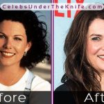 Lauren Graham Nose Job Results