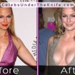 Melora Hardin Before After Photos