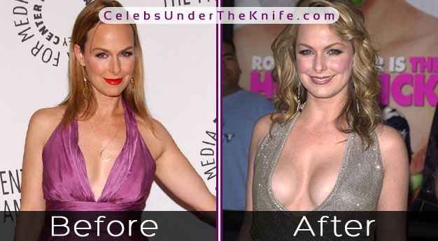 Melora Hardin Before After Photos