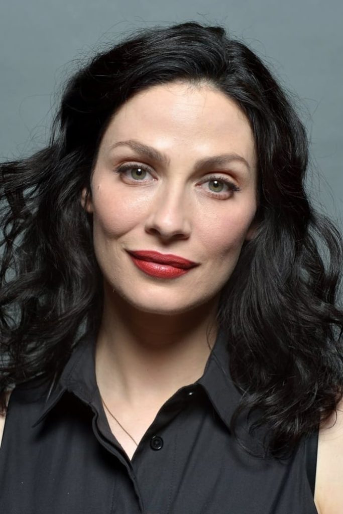 Joanne Kelly Plastic Surgery Face