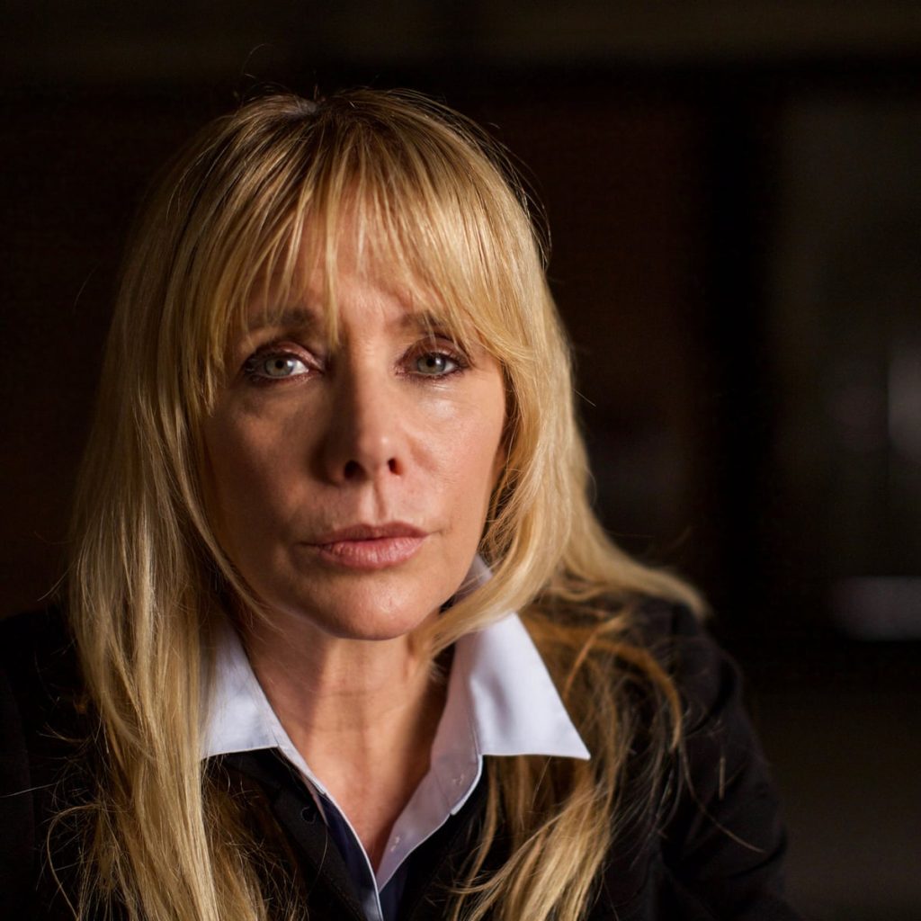 Rosanna Arquette Cosmetic Surgery Face