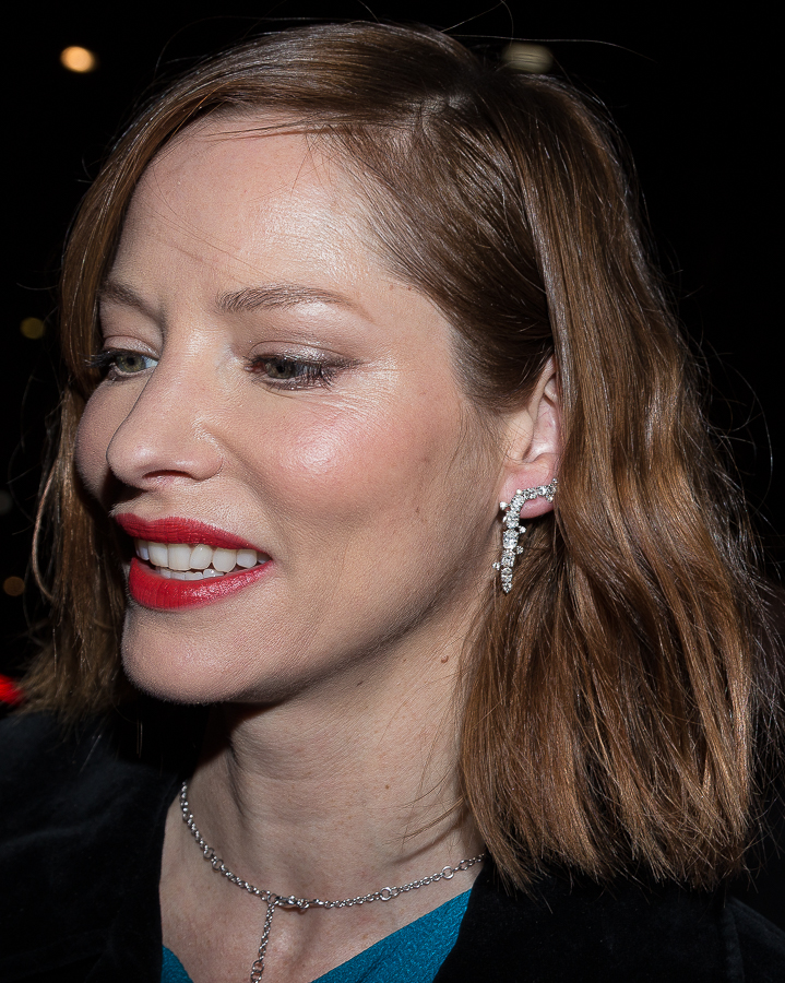 Sienna Guillory Plastic Surgery Face