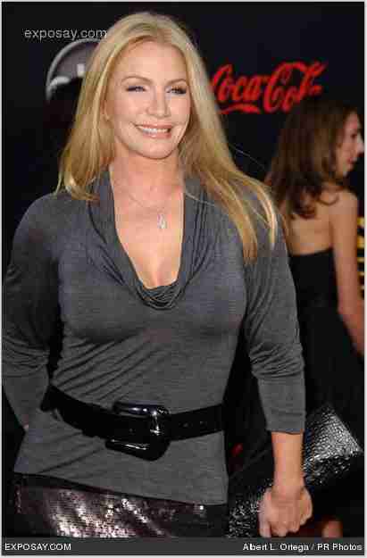 Shannon Tweed Boob Job Facelift