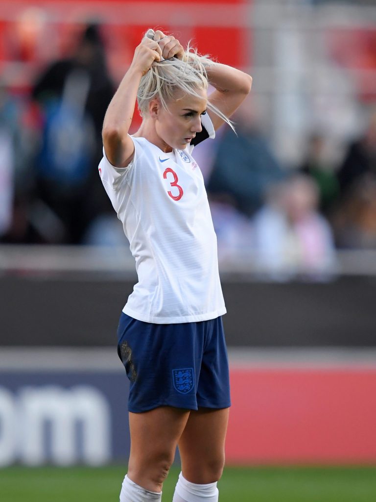 Alex Greenwood Plastic Surgery Body