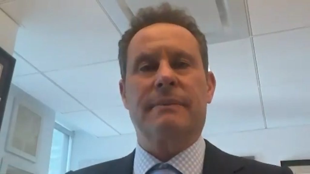 Brian Kilmeade Plastic Surgery Face