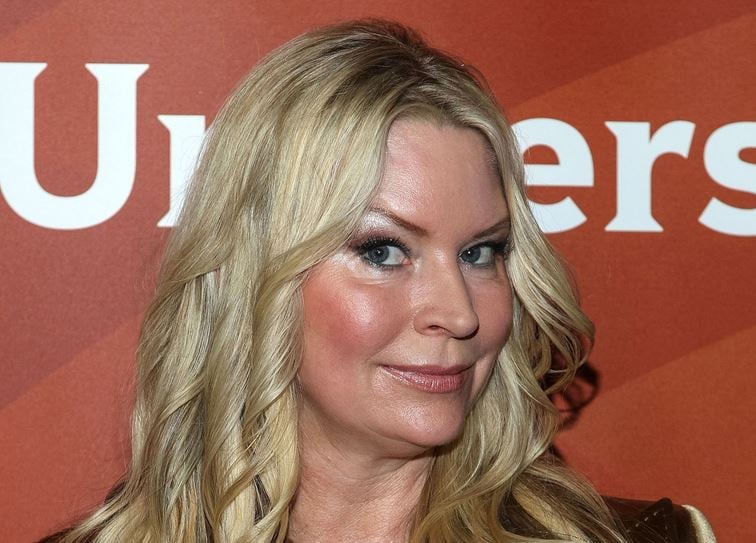 Jackie Siegel Cosmetic Surgery Face
