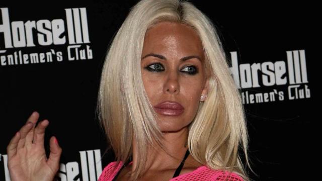 Shauna Sand Plastic Surgery Face